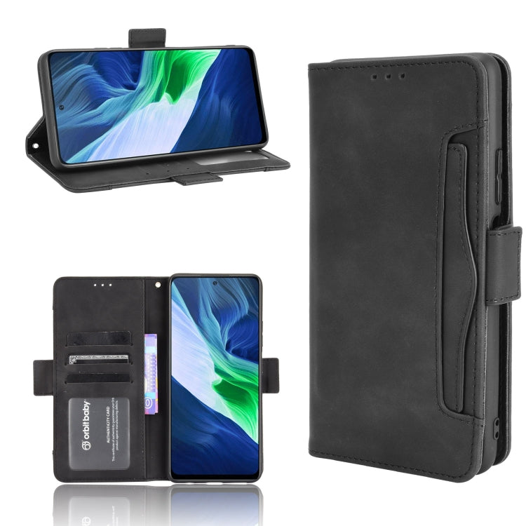 For Infinix Note 10 Pro/Note 10 Pro NFC Skin Feel Calf Pattern Horizontal Flip Leather Case with Holder & Card Slots & Photo Frame