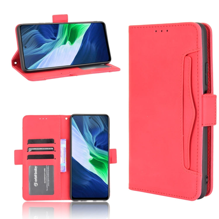 For Infinix Note 10 Pro/Note 10 Pro NFC Skin Feel Calf Pattern Horizontal Flip Leather Case with Holder & Card Slots & Photo Frame