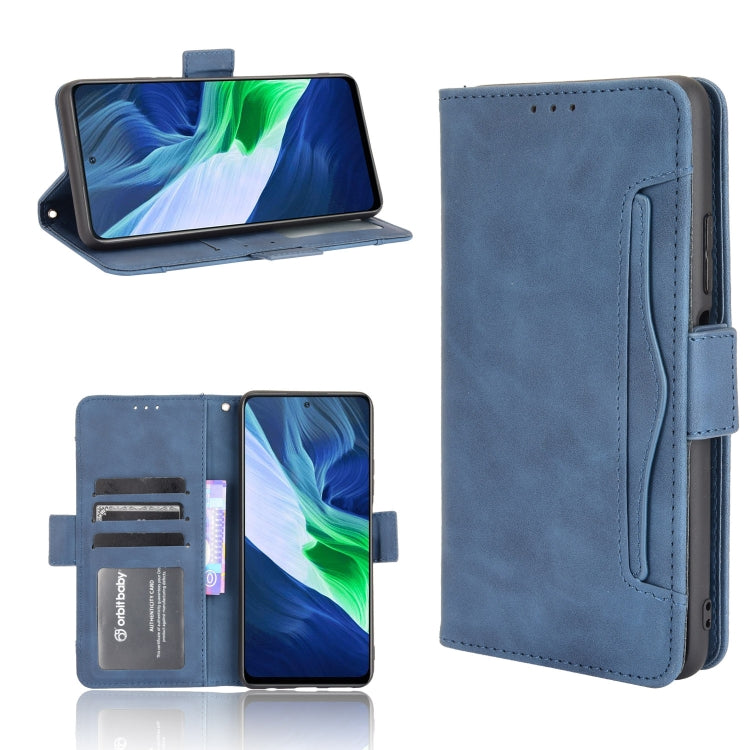 For Infinix Note 10 Pro/Note 10 Pro NFC Skin Feel Calf Pattern Horizontal Flip Leather Case with Holder & Card Slots & Photo Frame