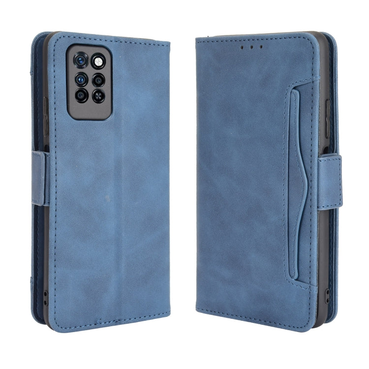 For Infinix Note 10 Pro/Note 10 Pro NFC Skin Feel Calf Pattern Horizontal Flip Leather Case with Holder & Card Slots & Photo Frame