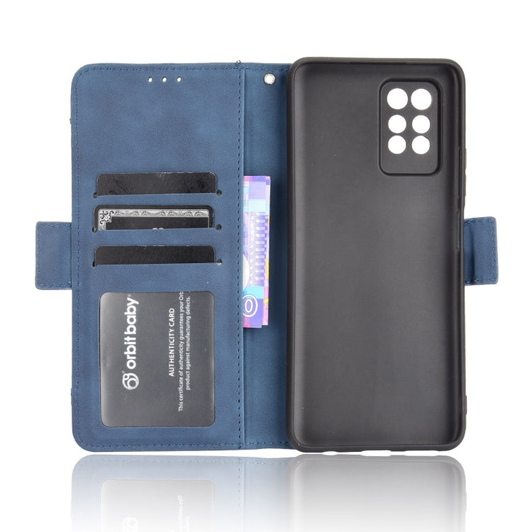 For Infinix Note 10 Pro/Note 10 Pro NFC Skin Feel Calf Pattern Horizontal Flip Leather Case with Holder & Card Slots & Photo Frame