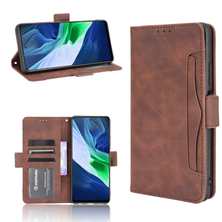 For Infinix Note 10 Pro/Note 10 Pro NFC Skin Feel Calf Pattern Horizontal Flip Leather Case with Holder & Card Slots & Photo Frame