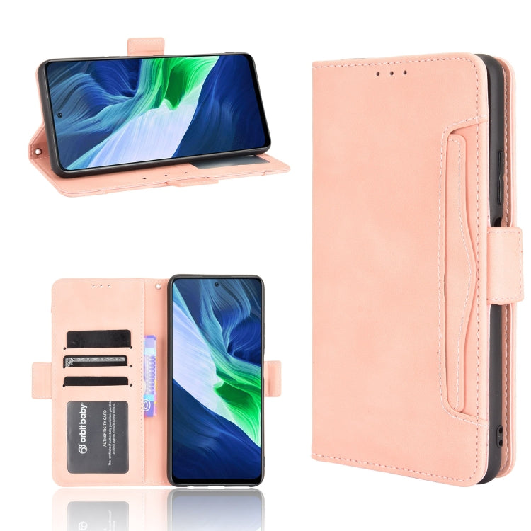 For Infinix Note 10 Pro/Note 10 Pro NFC Skin Feel Calf Pattern Horizontal Flip Leather Case with Holder & Card Slots & Photo Frame