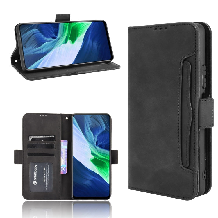 For Infinix Note 10 Skin Feel Calf Pattern Horizontal Flip Leather Case with Holder & Card Slots & Photo Frame