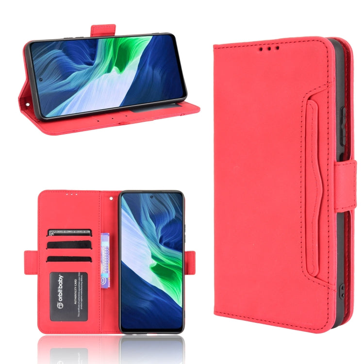 For Infinix Note 10 Skin Feel Calf Pattern Horizontal Flip Leather Case with Holder & Card Slots & Photo Frame