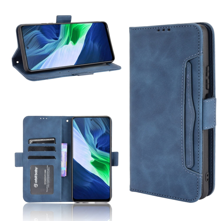 For Infinix Note 10 Skin Feel Calf Pattern Horizontal Flip Leather Case with Holder & Card Slots & Photo Frame