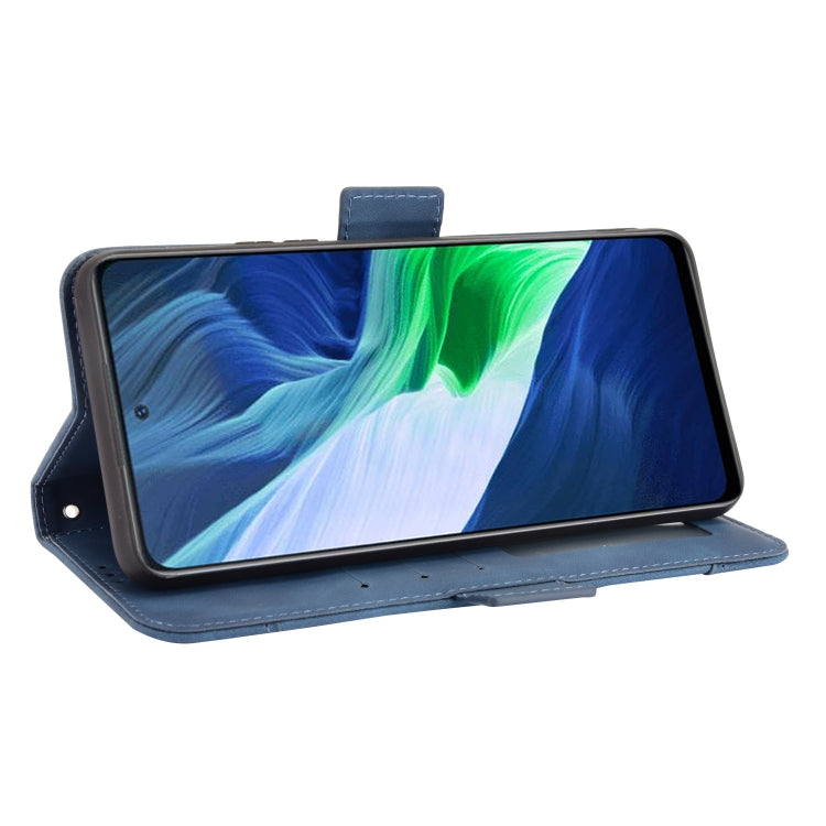 For Infinix Note 10 Skin Feel Calf Pattern Horizontal Flip Leather Case with Holder & Card Slots & Photo Frame