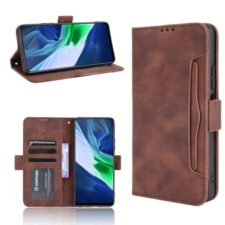 For Infinix Note 10 Skin Feel Calf Pattern Horizontal Flip Leather Case with Holder & Card Slots & Photo Frame
