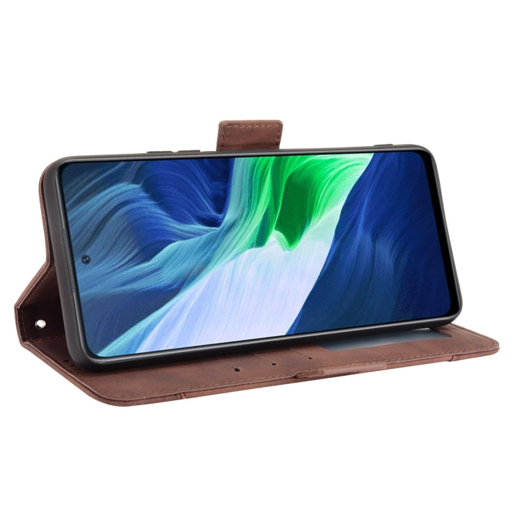 For Infinix Note 10 Skin Feel Calf Pattern Horizontal Flip Leather Case with Holder & Card Slots & Photo Frame