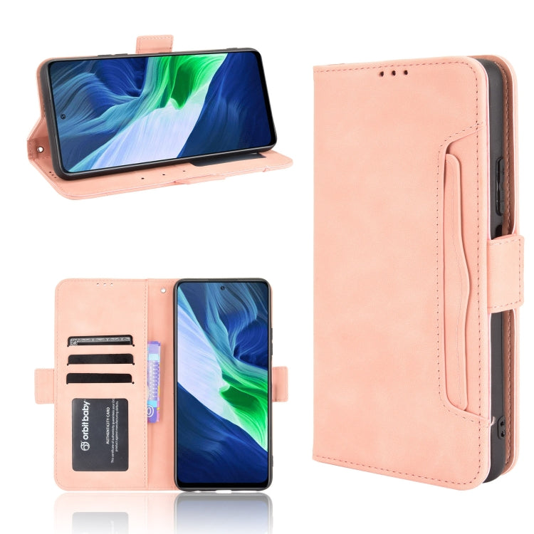 For Infinix Note 10 Skin Feel Calf Pattern Horizontal Flip Leather Case with Holder & Card Slots & Photo Frame