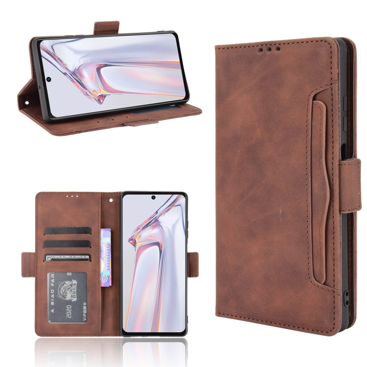 For Blackview A100 Skin Feel Calf Pattern Horizontal Flip Leather Case with Holder & Card Slots & Photo Frame