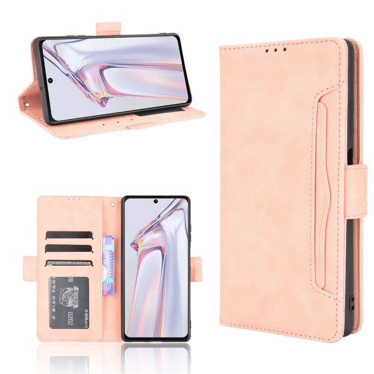 For Blackview A100 Skin Feel Calf Pattern Horizontal Flip Leather Case with Holder & Card Slots & Photo Frame
