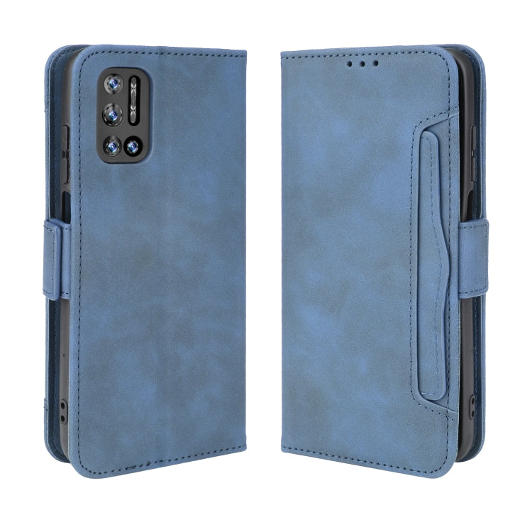 For Doogee N40 Pro Skin Feel Calf Pattern Horizontal Flip Leather Case with Holder & Card Slots & Photo Frame