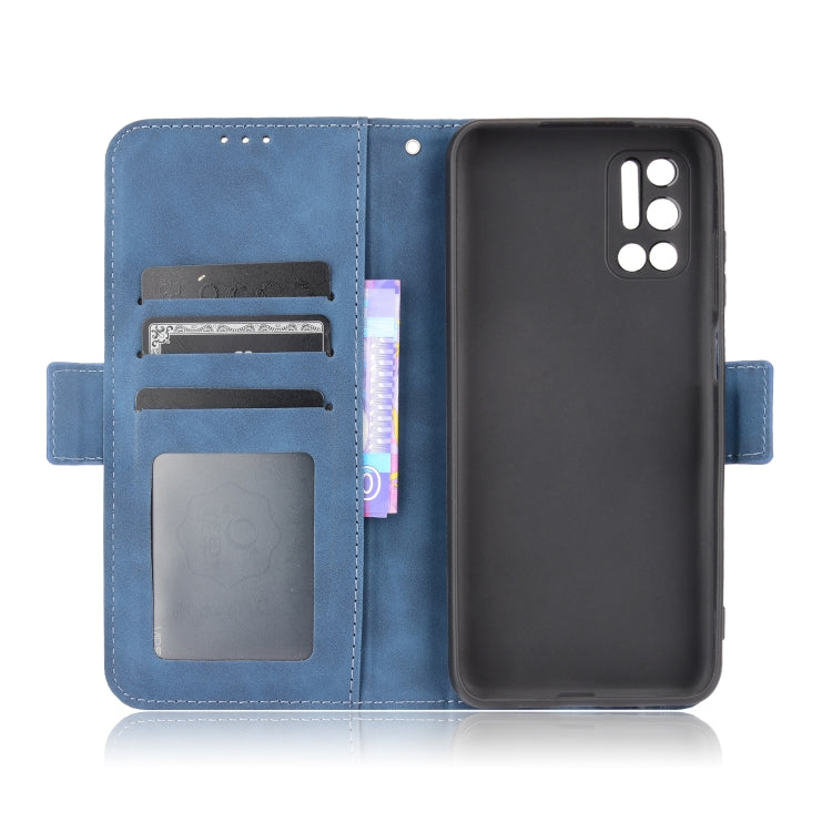 For Doogee N40 Pro Skin Feel Calf Pattern Horizontal Flip Leather Case with Holder & Card Slots & Photo Frame