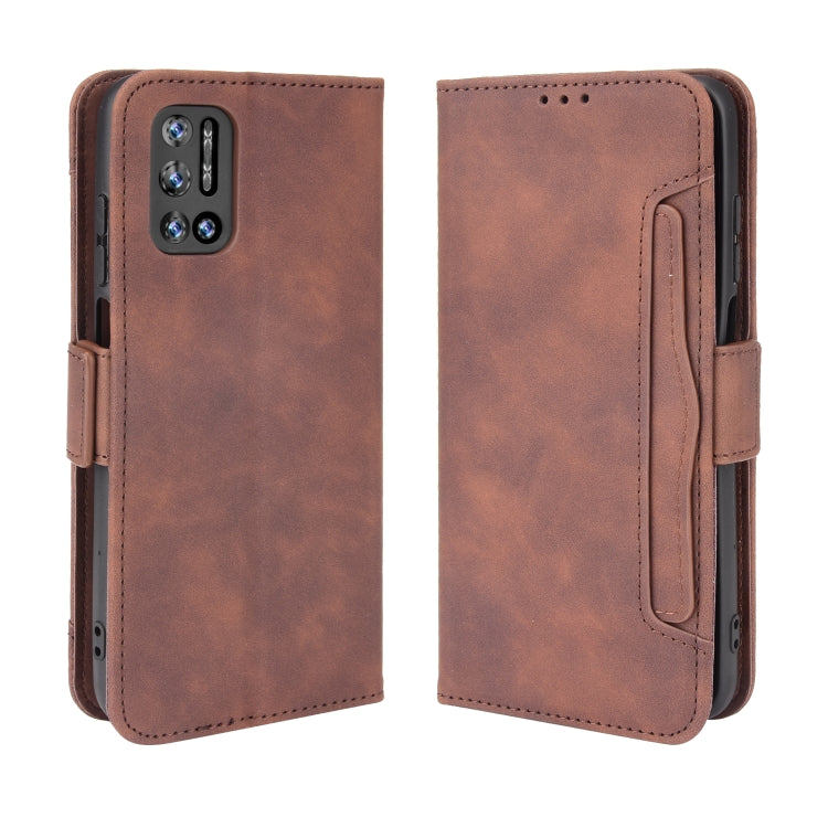 For Doogee N40 Pro Skin Feel Calf Pattern Horizontal Flip Leather Case with Holder & Card Slots & Photo Frame
