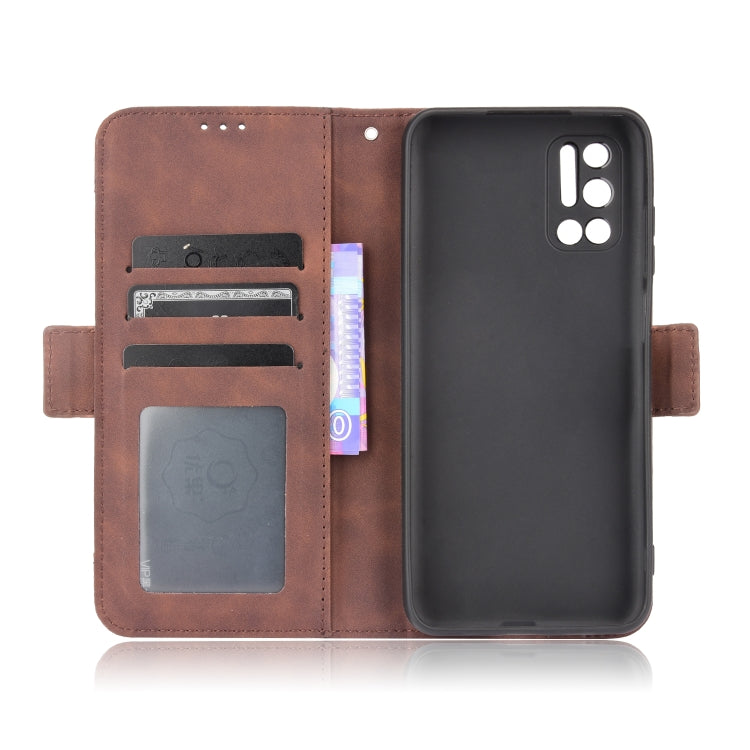 For Doogee N40 Pro Skin Feel Calf Pattern Horizontal Flip Leather Case with Holder & Card Slots & Photo Frame