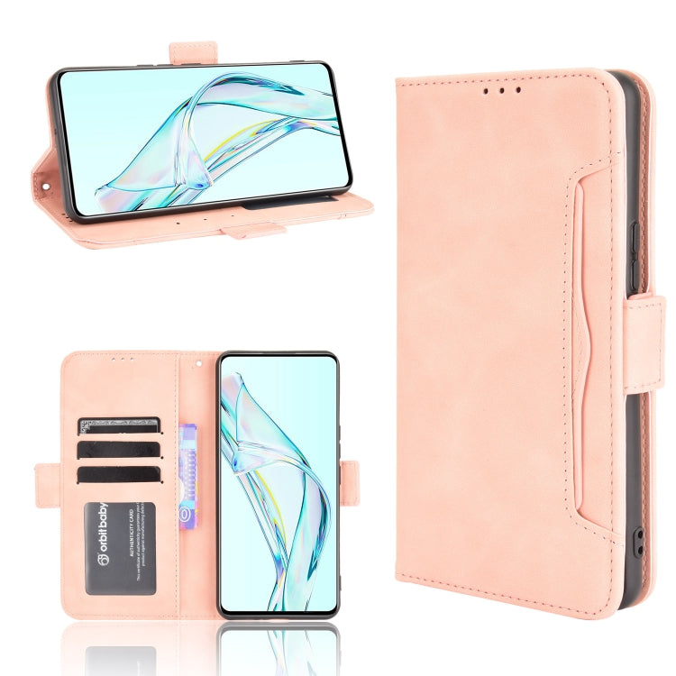 For ZTE Axon 30 5G Skin Feel Calf Pattern Horizontal Flip Leather Case with Holder & Card Slots & Photo Frame