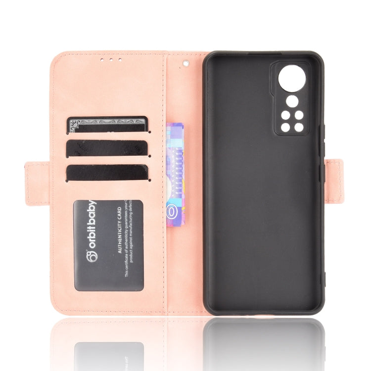 For ZTE Axon 30 5G Skin Feel Calf Pattern Horizontal Flip Leather Case with Holder & Card Slots & Photo Frame