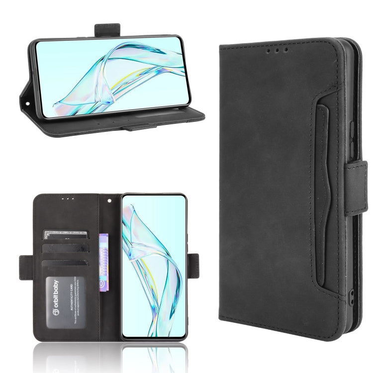 For ZTE Axon 30 5G Skin Feel Calf Pattern Horizontal Flip Leather Case with Holder & Card Slots & Photo Frame