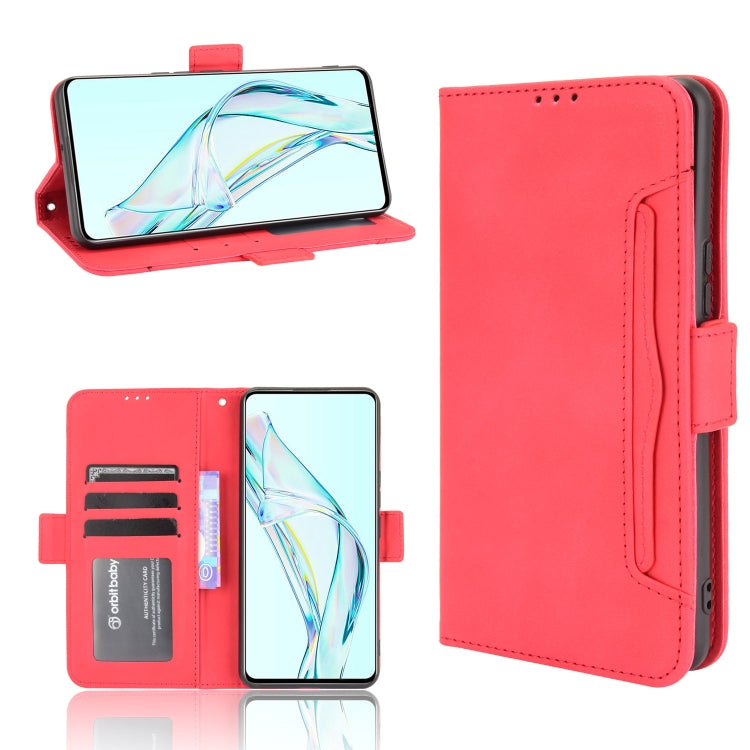 For ZTE Axon 30 5G Skin Feel Calf Pattern Horizontal Flip Leather Case with Holder & Card Slots & Photo Frame