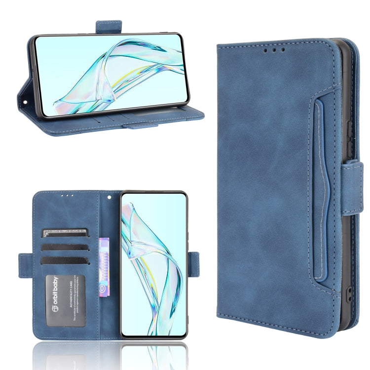 For ZTE Axon 30 5G Skin Feel Calf Pattern Horizontal Flip Leather Case with Holder & Card Slots & Photo Frame