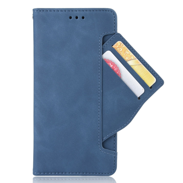 For ZTE Axon 30 5G Skin Feel Calf Pattern Horizontal Flip Leather Case with Holder & Card Slots & Photo Frame