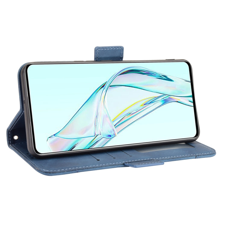 For ZTE Axon 30 5G Skin Feel Calf Pattern Horizontal Flip Leather Case with Holder & Card Slots & Photo Frame