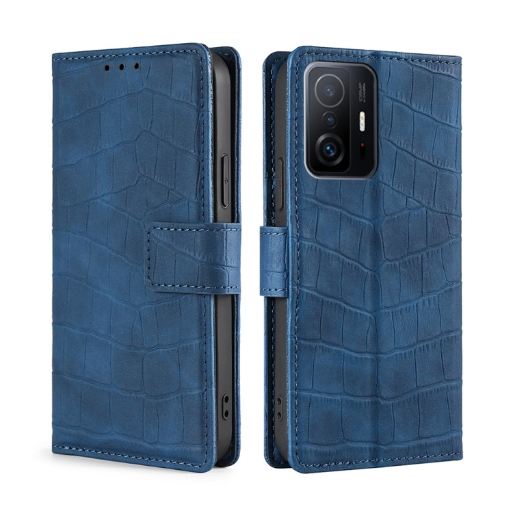 For Xiaomi Mi 11T Skin Feel Crocodile Texture Magnetic Clasp Horizontal Flip PU Leather Case with Holder & Card Slots & Wallet