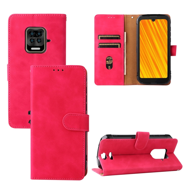 For Doogee S59 / S59 Pro Solid Color Skin Feel Magnetic Buckle Horizontal Flip Calf Texture PU Leather Case with Holder & Card Slots & Wallet