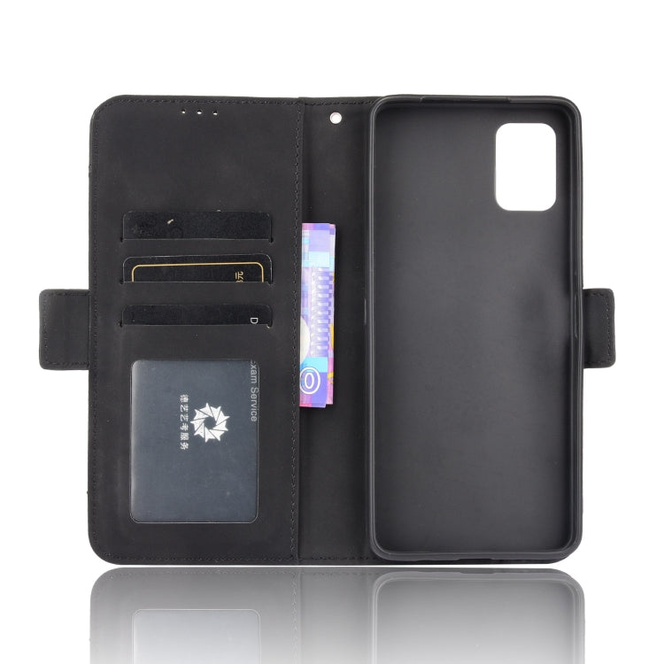 For Umidigi A11 Pro Max Skin Feel Calf Pattern Horizontal Flip Leather Case with Holder & Card Slots & Photo Frame
