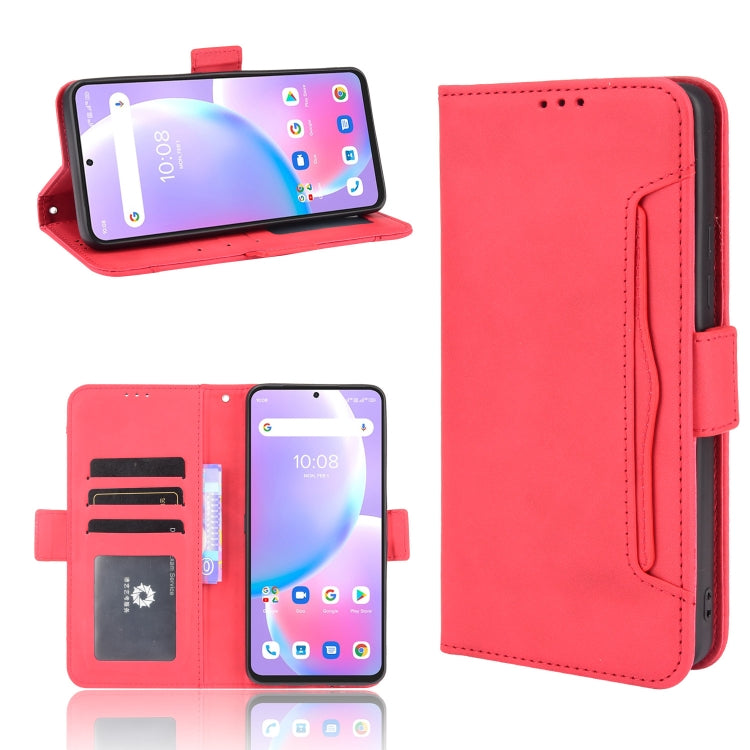 For Umidigi A11 Pro Max Skin Feel Calf Pattern Horizontal Flip Leather Case with Holder & Card Slots & Photo Frame