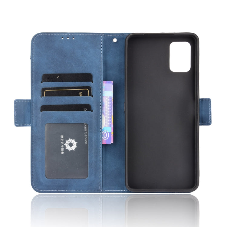 For Umidigi A11 Pro Max Skin Feel Calf Pattern Horizontal Flip Leather Case with Holder & Card Slots & Photo Frame
