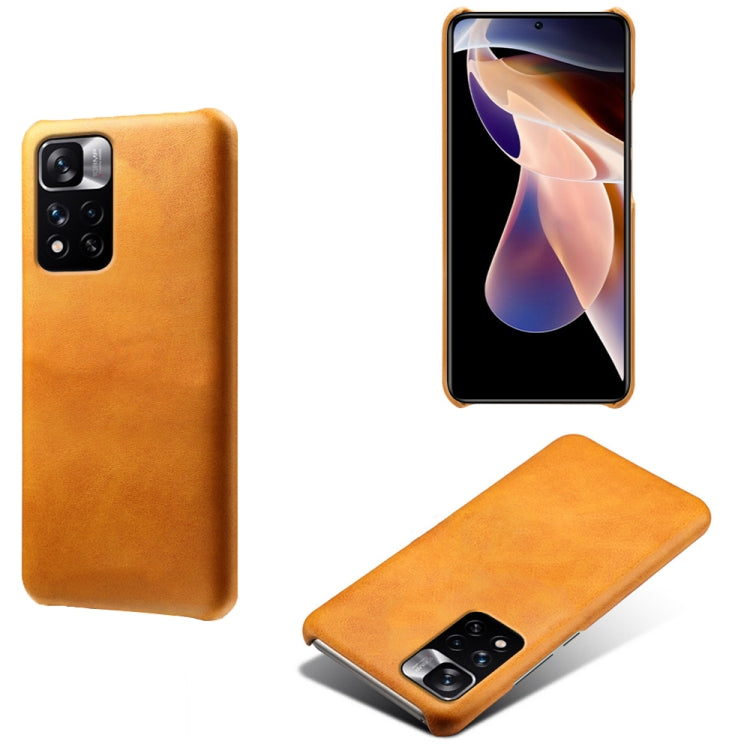For Xiaomi Redmi Note 11 Pro 5G Calf Texture PC + PU Phone Case