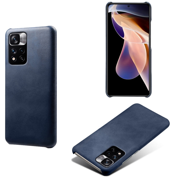 For Xiaomi Redmi Note 11 Pro+ Calf Texture PC + PU Phone Case
