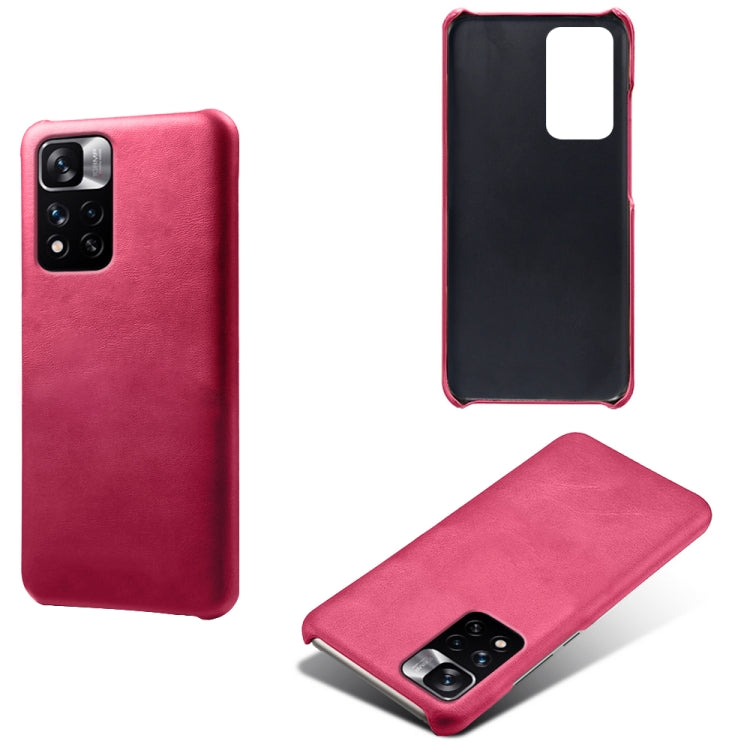 For Xiaomi Redmi Note 11 Pro+ Calf Texture PC + PU Phone Case