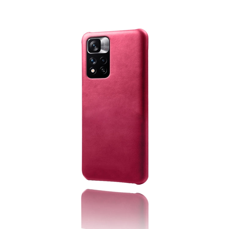 For Xiaomi Redmi Note 11 Pro+ Calf Texture PC + PU Phone Case