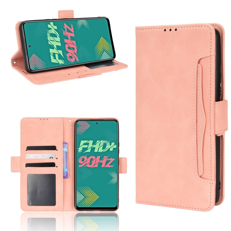 For Infinix Hot 11S Skin Feel Calf Pattern Leather Phone Case