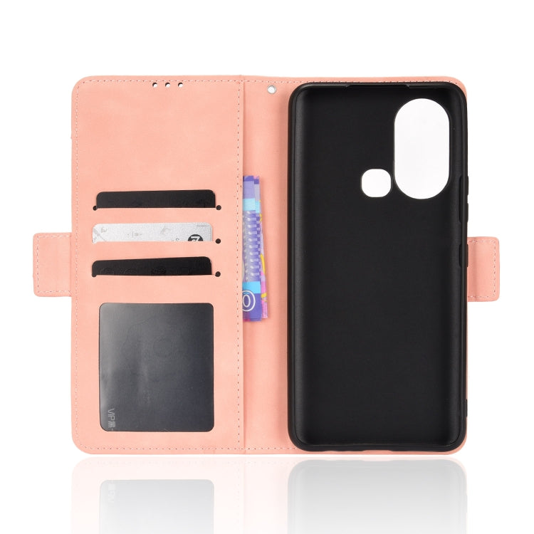 For Infinix Hot 11S Skin Feel Calf Pattern Leather Phone Case