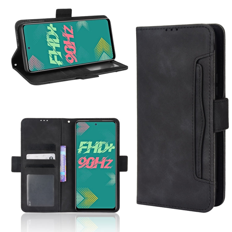 For Infinix Hot 11S Skin Feel Calf Pattern Leather Phone Case