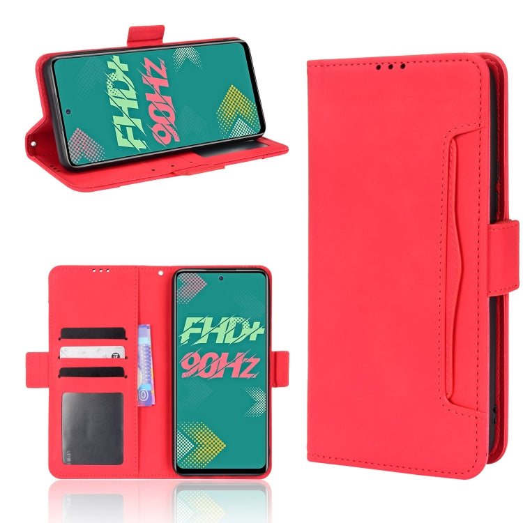 For Infinix Hot 11S Skin Feel Calf Pattern Leather Phone Case