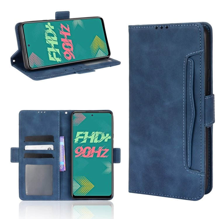 For Infinix Hot 11S Skin Feel Calf Pattern Leather Phone Case