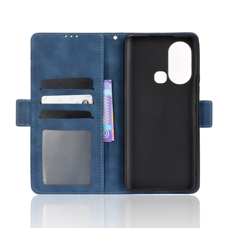 For Infinix Hot 11S Skin Feel Calf Pattern Leather Phone Case