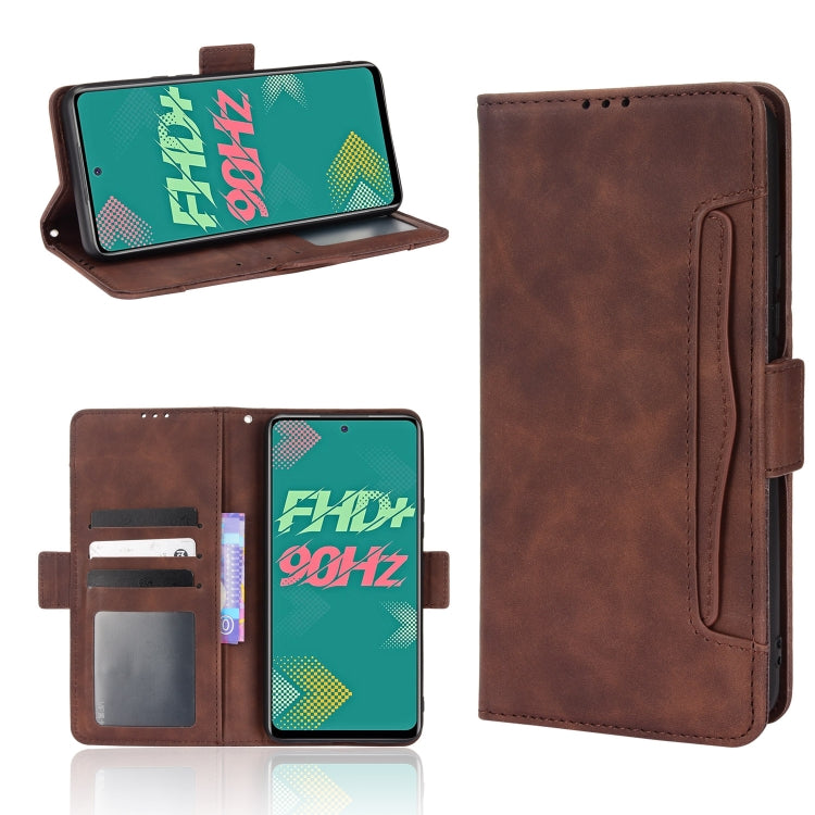 For Infinix Hot 11S Skin Feel Calf Pattern Leather Phone Case
