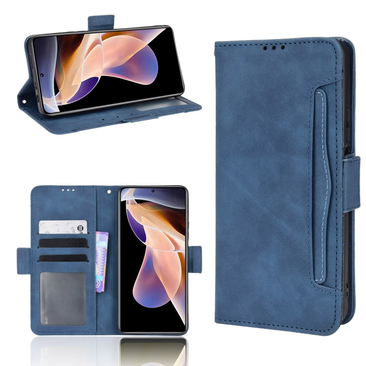 For Xiaomi Redmi Note 11 Pro Skin Feel Calf Pattern Leather Phone Case