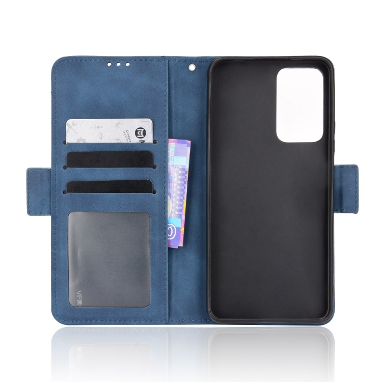 For Xiaomi Redmi Note 11 Pro Skin Feel Calf Pattern Leather Phone Case