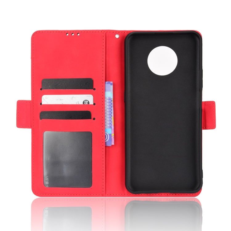 For Nokia G300 Skin Feel Calf Pattern Leather Phone Case