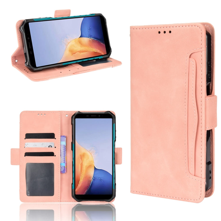 For Ulefone Armor X9 Skin Feel Calf Pattern Leather Phone Case