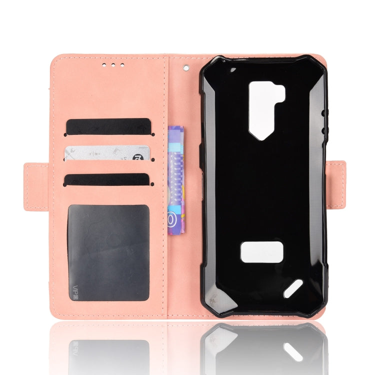 For Ulefone Armor X9 Skin Feel Calf Pattern Leather Phone Case