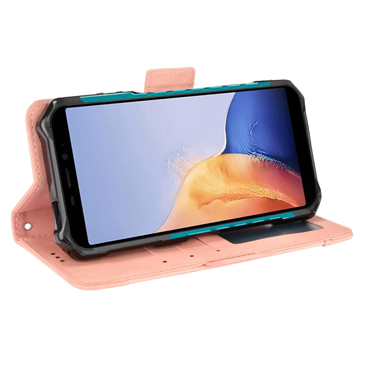 For Ulefone Armor X9 Skin Feel Calf Pattern Leather Phone Case
