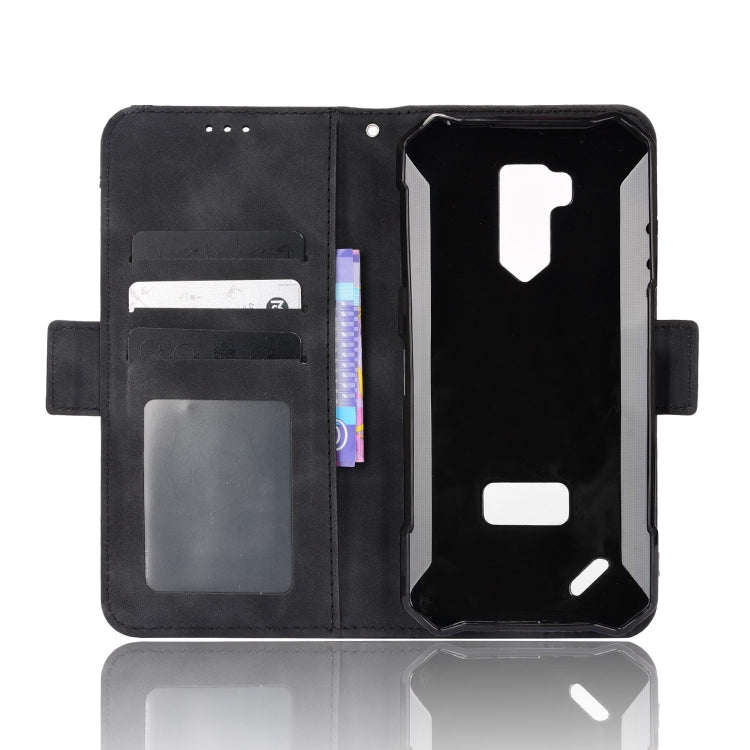 For Ulefone Armor X9 Skin Feel Calf Pattern Leather Phone Case